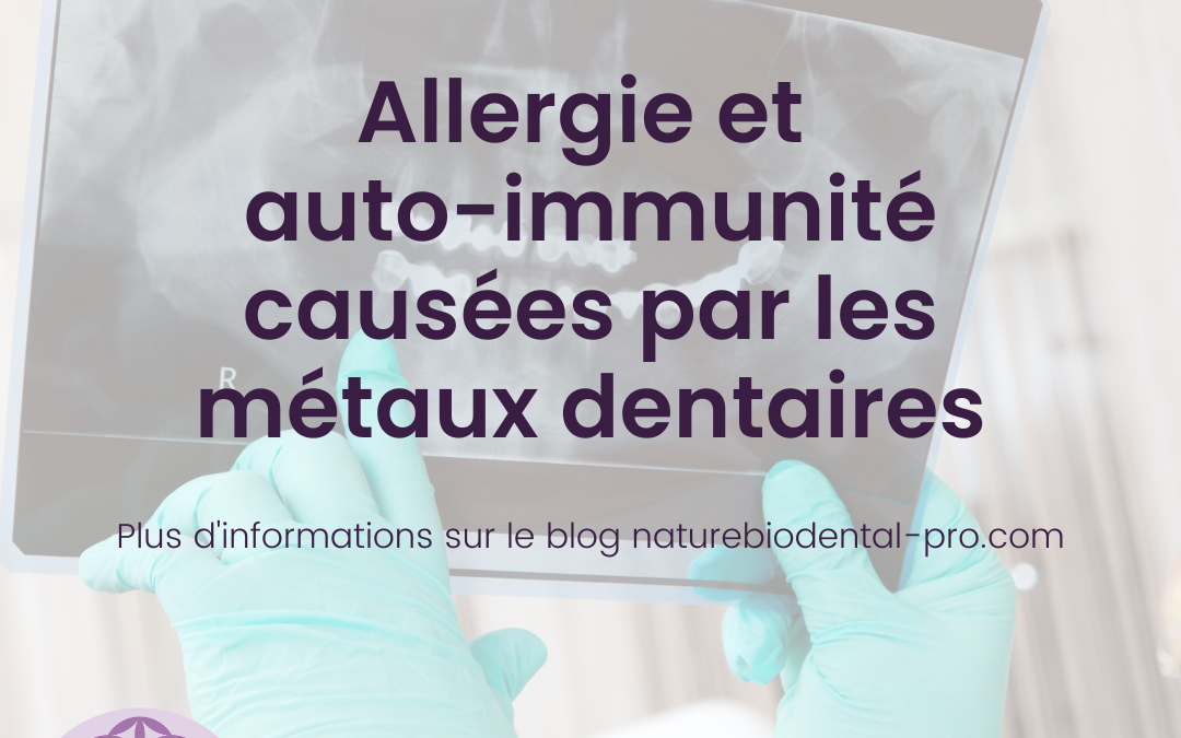 Allergie et auto-immunité causées par les métaux dentaires