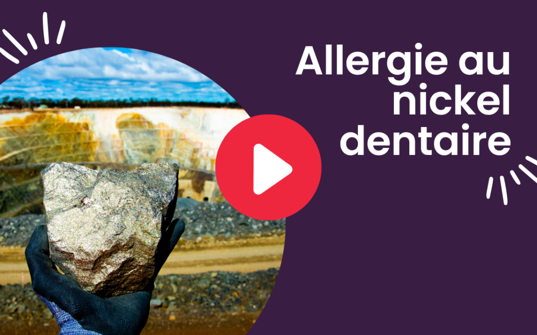 Allergie au nickel dentaire (vidéo)