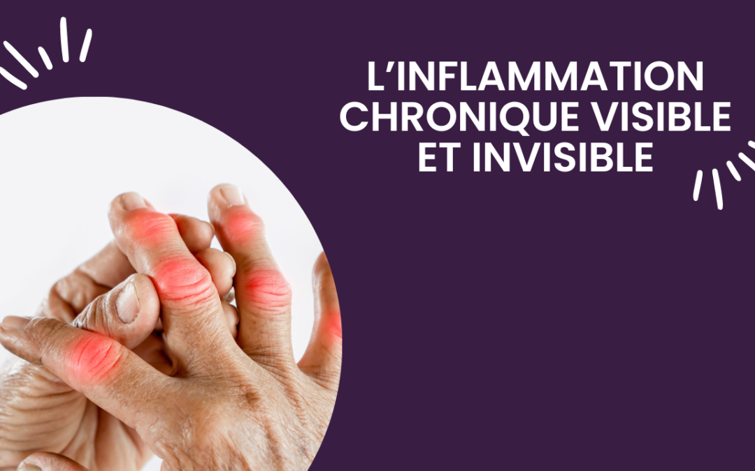 Inflammation chronique visible et invisible