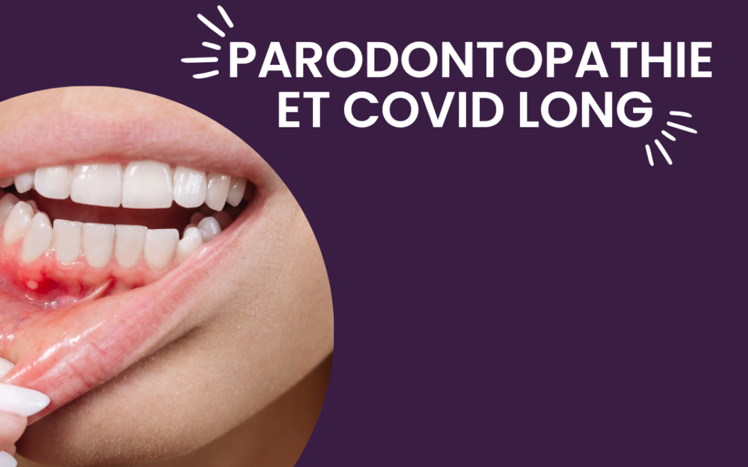 PARODONTOPATHIE ET COVID LONG 