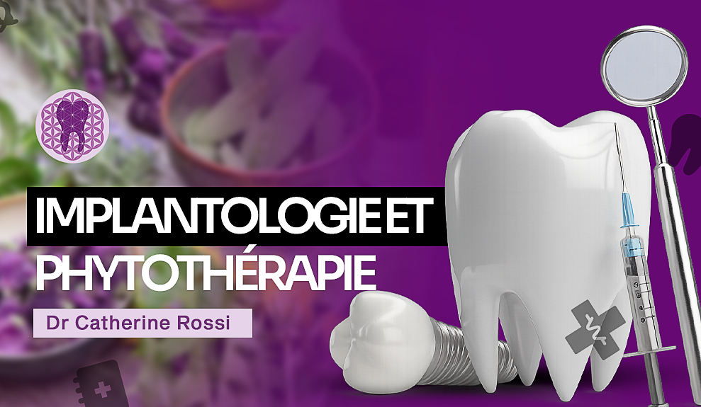 IMPLANTOLOGIE ET PHYTOTHÉRAPIE -TOUT SAVOIR