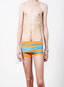 IMPLANTOLOGIE ET PHYTOTHÉRAPIE