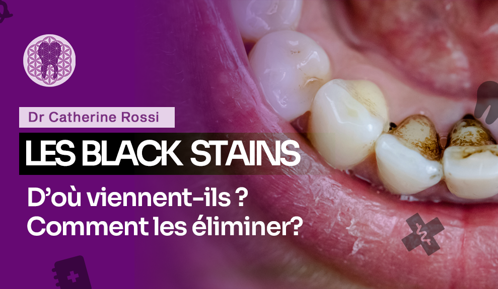 LES BLACK STAINS : D’OÙ VIENNENT-ILS ? COMMENT LES ÉLIMINER ?